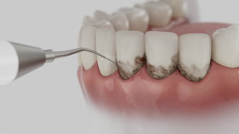 Reliable Tooth Extraction contractor in Point, TX by Smile Center Dentistry
